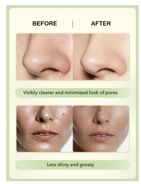 skincare