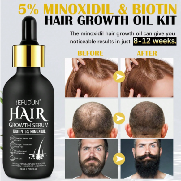 Minoxidil serum